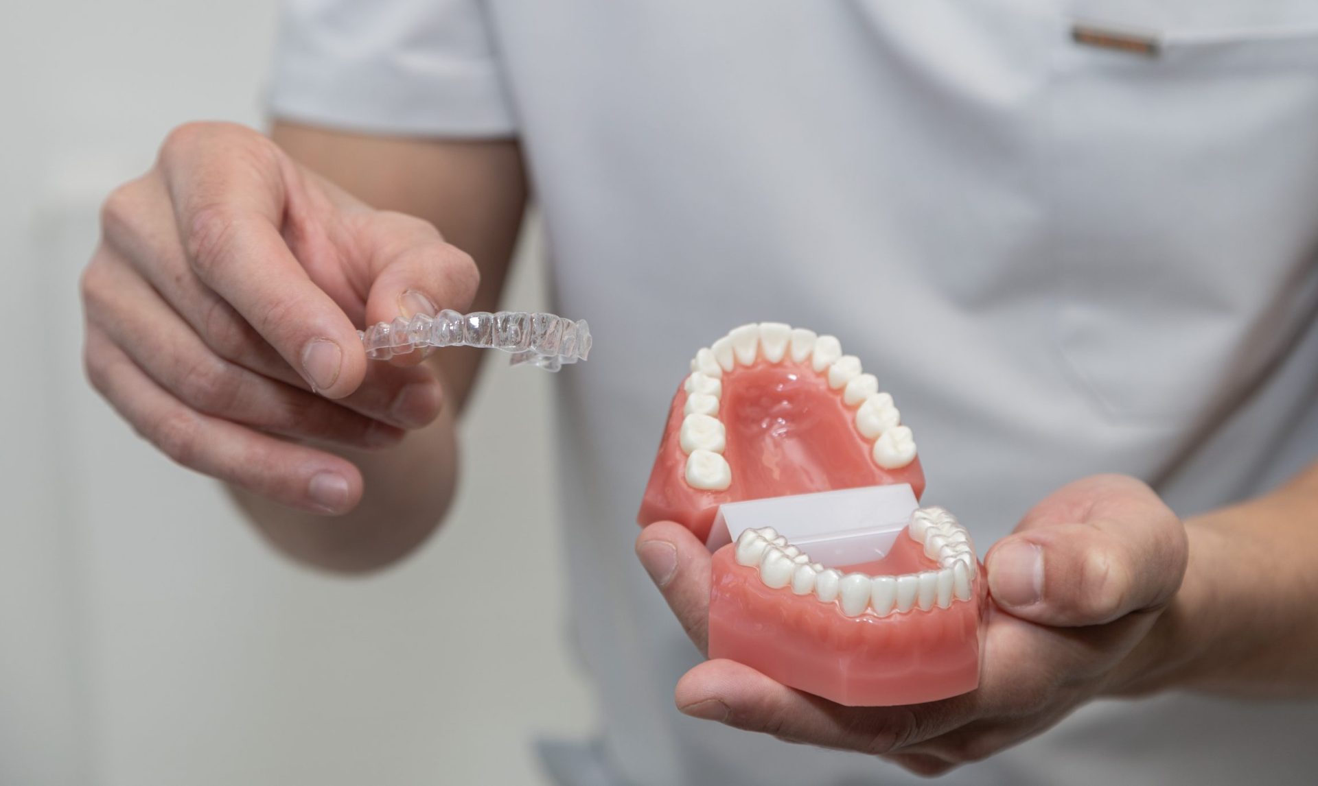 Clear Aligners