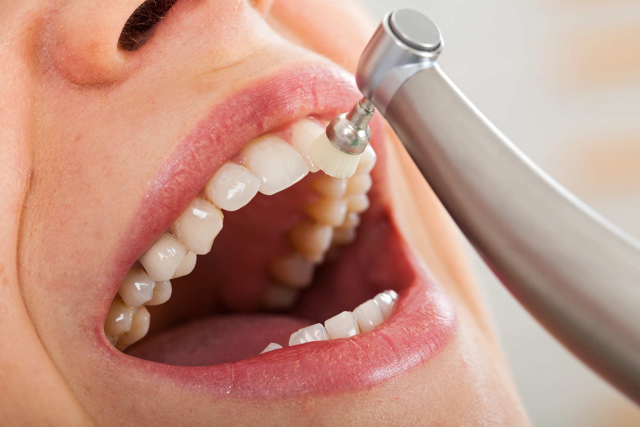 Dental Hygiene